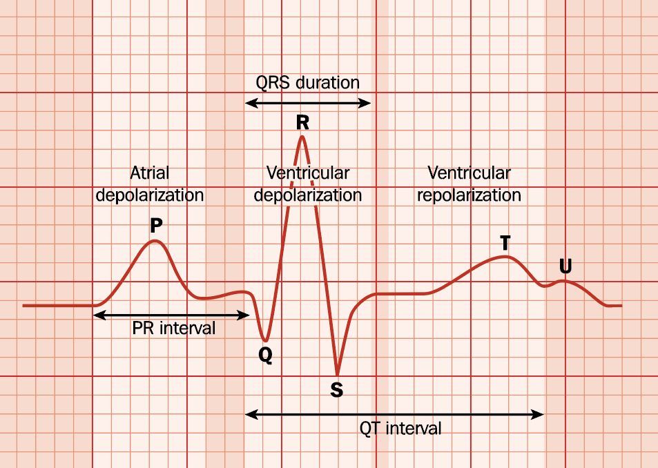 ECG trace showing QT interval.